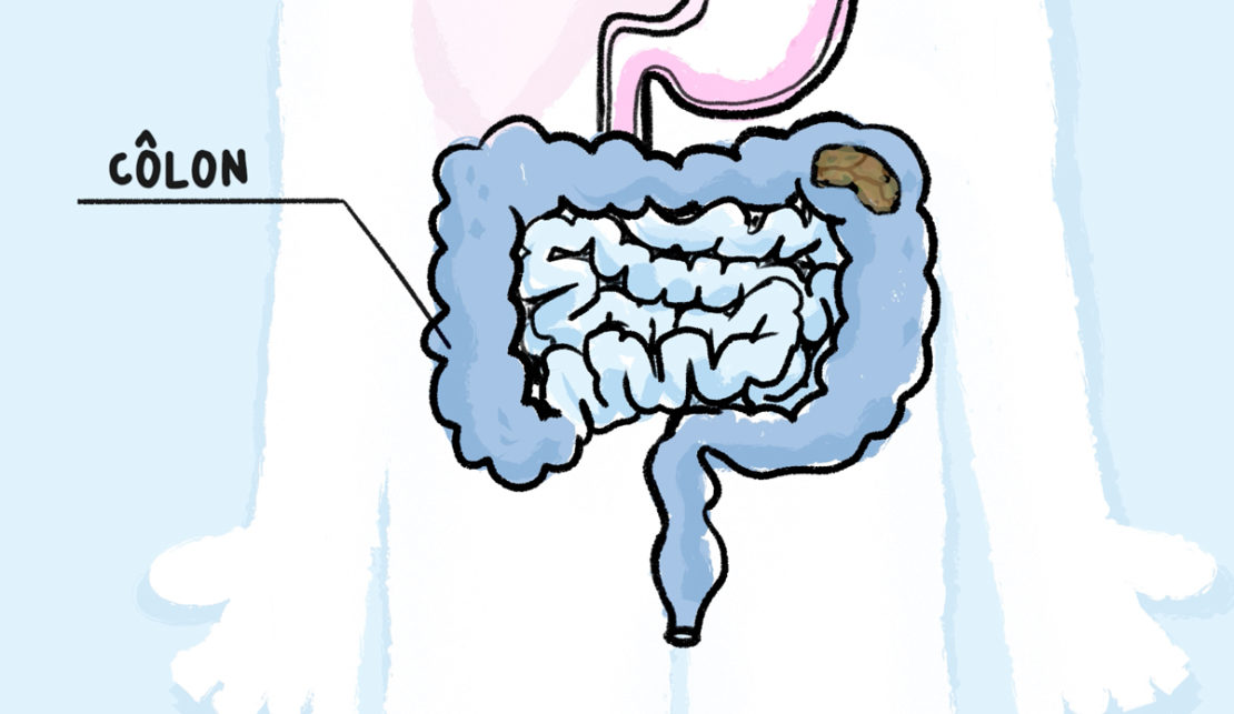 Schéma du côlon
Illustrations : Rémy Nardoux